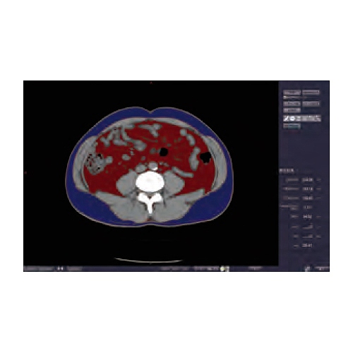 CT体脂肪測定 | 映像情報Medical