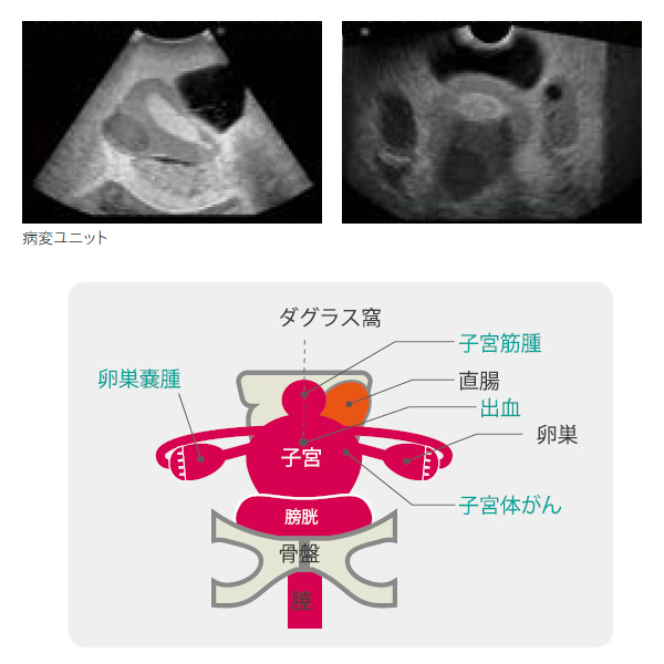 US-10 婦人科超音波診断ファントム | 映像情報Medical