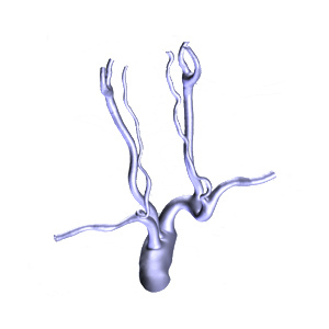 3D血管モデル | 映像情報Medical
