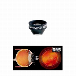 【美品・50% off】実況！硝子体手術 Tips 165 実況！ 硝子体手術Tips165 - 眼科専門書店 オー・ビー・エス
