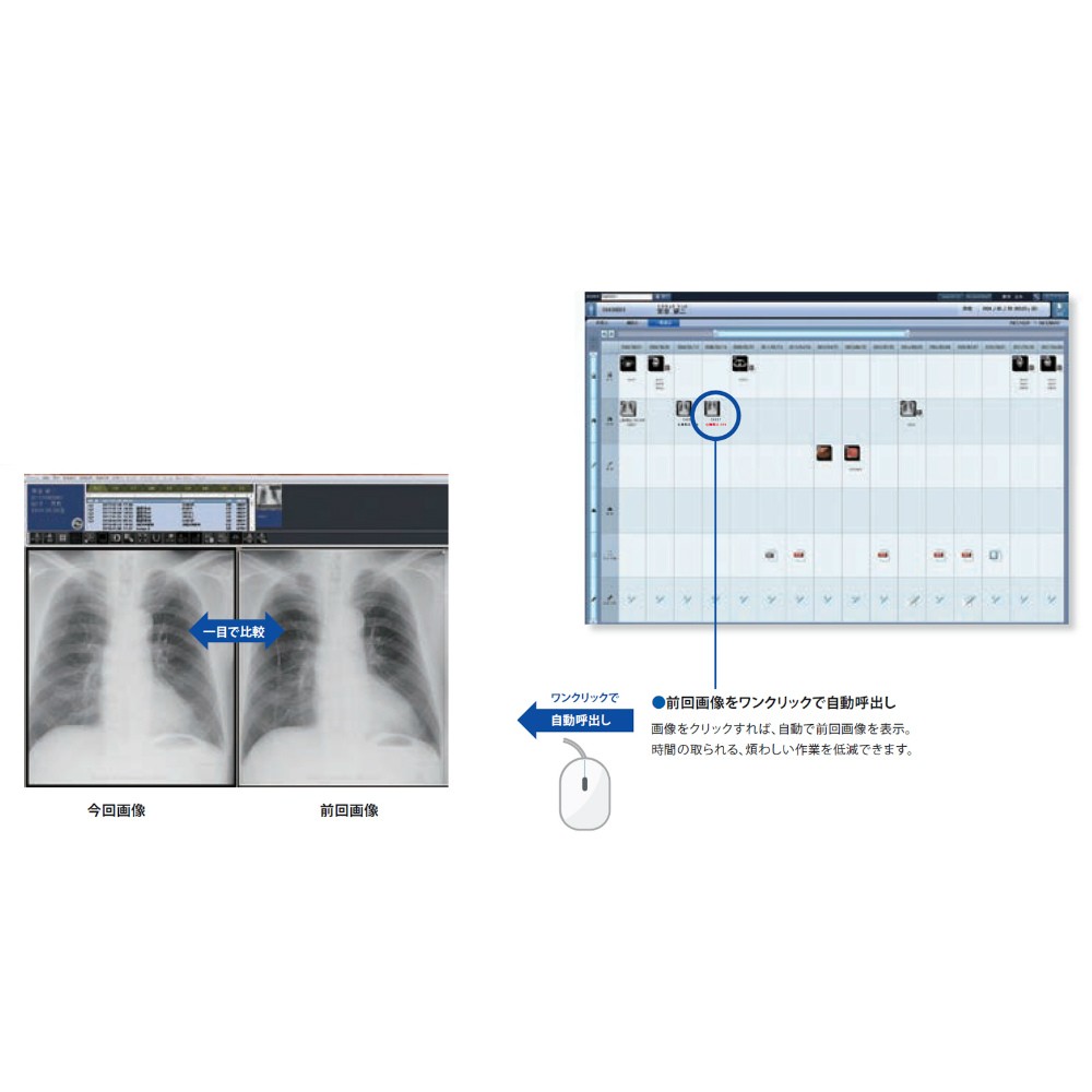 医用画像情報システム Rapideye Core™ Smart Edition TFS 医用画像情報システム Rapideye Core™ Smart Edition TFS
