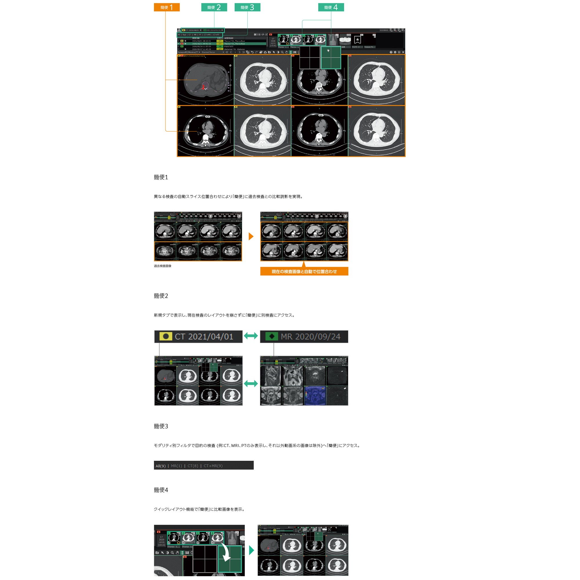 AIプラットフォーム SYNAPSE SAI viewer | 映像情報Medical AIプラットフォーム SYNAPSE SAI viewer | 映像情報Medical