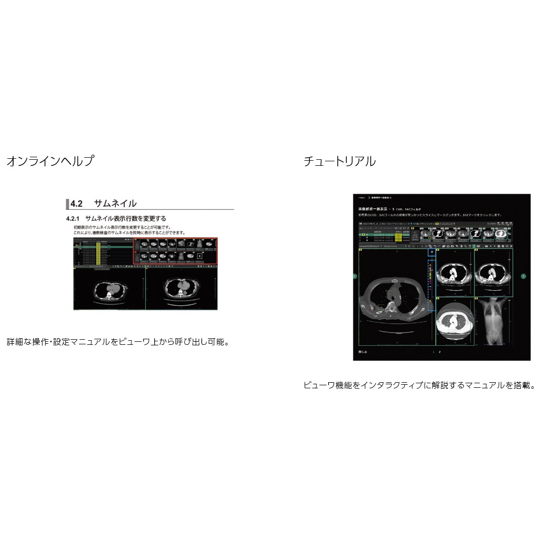 AIプラットフォーム SYNAPSE SAI viewer | 映像情報Medical AIプラットフォーム SYNAPSE SAI viewer | 映像情報Medical