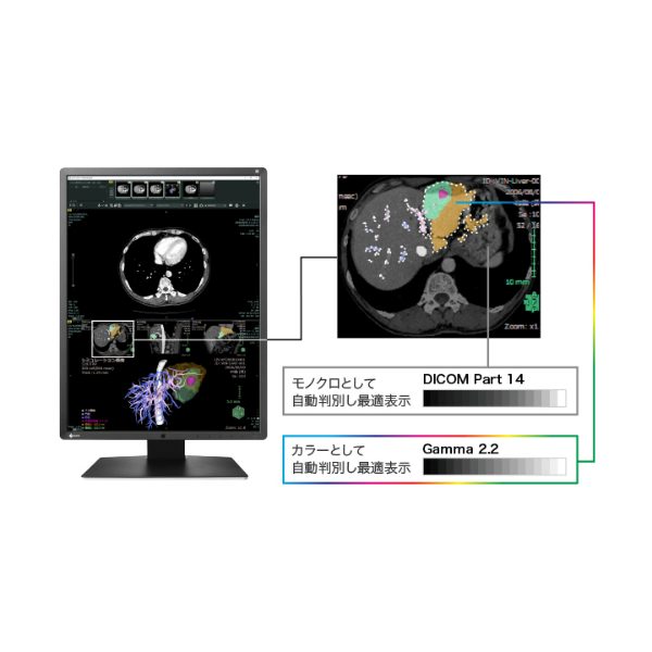 医用画像表示モニターRadiForce RX660 | 映像情報Medical