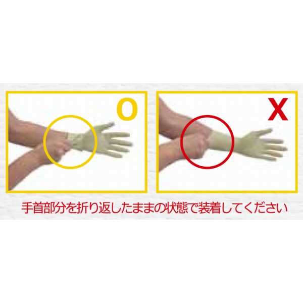 UniRay 放射線防護用手袋 | 映像情報Medical