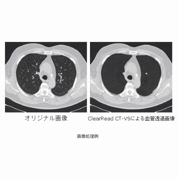 柔らかな質感の 裁断済※胸部のCT 第4版 健康・医学 - 健康・医学